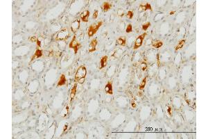Immunoperoxidase of monoclonal antibody to SERPING1 on formalin-fixed paraffin-embedded human kidney. (SERPING1 antibody  (AA 1-500))