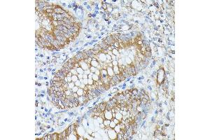 Immunohistochemistry (IHC) image for anti-Pancreatic Lipase-Related Protein 1 (PNLIPRP1) (AA 298-467) antibody (ABIN7269167)