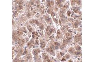 Immunohistochemistry of TREX2 in human liver tissue with this product at 2.