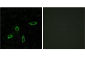 Immunofluorescence analysis of LOVO cells, using EDG4 Antibody. (EDG4 antibody  (AA 290-339))