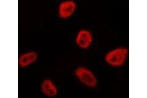 ABIN6275131 staining HepG2 by IF/ICC. (FOXN4 antibody  (C-Term))