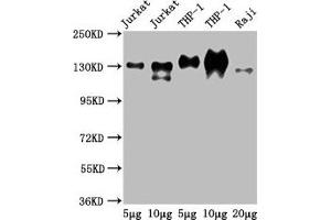 Western Blot Positive WB detected in: Jurkat whole cell lysate, THP-1 whole cell lysate, Raji whole cell lysate All lanes: CD31 antibody at 2. (CD31 antibody  (AA 28-315))
