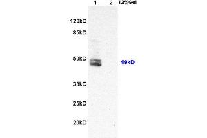 Lane 1: rat liver lysates Lane 2: rat brain lysates probed with Anti Hepatitis C Virus NS5a Polyclonal Antibody, Unconjugated (ABIN1385124) at 1:200 in 4 °C. (HCV NS5a antibody)