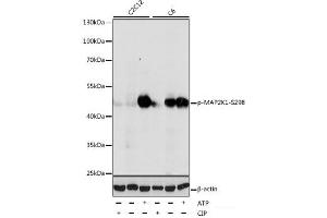 Western blot analysis of extracts of various cell lines using Phospho-MAP2K1(S298) Polyclonal Antibody at dilution of 1:1000. (MEK1 antibody  (pSer298))