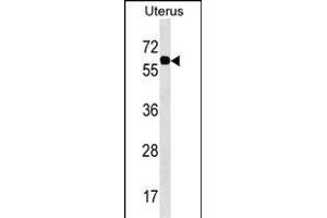 PGM3 Antibody (Center) (ABIN1538149 and ABIN2850274) western blot analysis in Uterus tissue lysates (35 μg/lane). (Phosphoglucomutase 3 antibody  (AA 237-263))