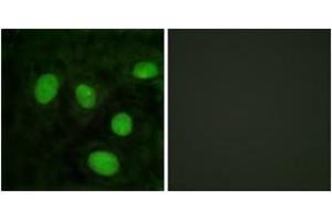 Immunofluorescence analysis of HeLa cells, using Histone H1 (Ab-25) Antibody. (Histone H1 antibody  (AA 131-180))