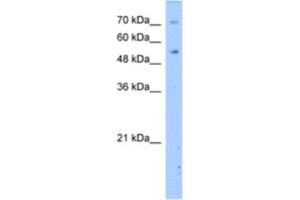 Western Blotting (WB) image for anti-Dihydropyrimidinase (DPYS) antibody (ABIN2462414) (DPYS antibody)