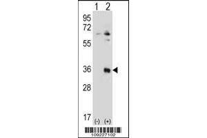 Western blot analysis of TSSK6 using rabbit polyclonal TSSK6 Antibody using 293 cell lysates (2 ug/lane) either nontransfected (Lane 1) or transiently transfected (Lane 2) with the TSSK6 gene. (TSSK6 antibody  (N-Term))