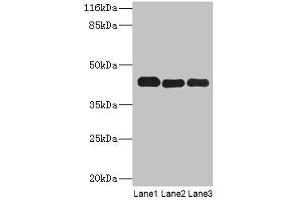 Western blot All lanes: PPME1 antibody at 2 μg/mL Lane 1: A549 whole cell lysate Lane 2: Hela whole cell lysate Lane 3: Mouse brain tissue Secondary Goat polyclonal to rabbit IgG at 1/10000 dilution Predicted band size: 43, 23, 19, 44 kDa Observed band size: 43 kDa (PPME1 antibody  (AA 201-386))