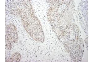 Immunohistochemistry (IHC) image for anti-DEAD (Asp-Glu-Ala-Asp) Box Polypeptide 21 (DDX21) (C-Term) antibody (ABIN7448516)