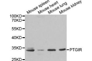 Western blot analysis of extracts of various cell lines, using PTGIR antibody. (Prostacyclin Receptor antibody  (AA 207-386))