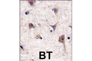 Formalin-fixed and paraffin-embedded human brain tissue reacted with Autophagy LC3 Antibody (G8a) (N-term), which was peroxidase-conjugated to the secondary antibody, followed by DAB staining. (MAP1LC3A antibody  (N-Term))