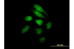 Immunofluorescence of purified MaxPab antibody to PER1 on HeLa cell. (PER1 antibody  (AA 1-1290))