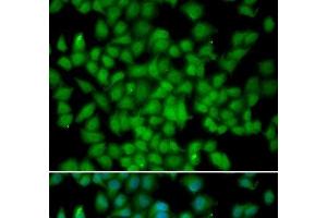 Immunofluorescence analysis of HeLa cells using CDKN2C Polyclonal Antibody (CDKN2C antibody)