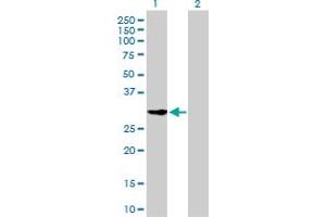 Western Blotting (WB) image for anti-Cyclin-Dependent Kinase 2 (CDK2) (AA 211-298) antibody (ABIN560288)