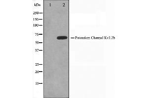 Western blot analysis on HepG2 cell lysate using KCNC2 Antibody,The lane on the left is treated with the antigen-specific peptide. (KCNC2 antibody  (C-Term))