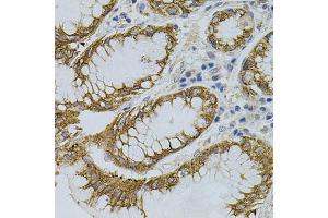 Immunohistochemistry of paraffin-embedded human stomach using SIGMAR1 antibody (ABIN5973191) (40x lens). (SIGMAR1 antibody)