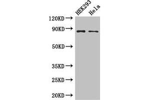 Western Blot Positive WB detected in: HEK293 whole cell lysate, Hela whole cell lysate All lanes: MLH1 antibody at 3 μg/mL Secondary Goat polyclonal to rabbit IgG at 1/50000 dilution Predicted band size: 85, 59, 74 kDa Observed band size: 85 kDa (MLH1 antibody  (AA 350-519))
