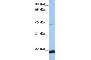 WB Suggested Anti-HBS1L Antibody Titration: 0.