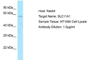 Host: Rabbit Target Name: SLC11A1 Sample Type: HT1080 Whole Cell lysates Antibody Dilution: 1. (SLC11A1 antibody  (Middle Region))