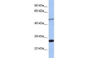 WB Suggested Anti-MIS12 Antibody Titration: 0. (MIS12 antibody  (Middle Region))