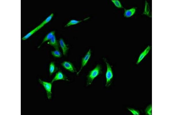 CIB2 antibody  (AA 65-164)