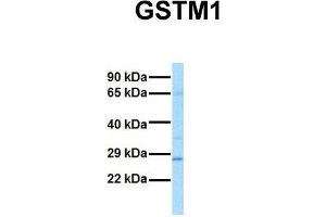 Host:  Rabbit  Target Name:  GSTM1  Sample Tissue:  Human Fetal Lung  Antibody Dilution:  1. (GSTM1 antibody  (N-Term))