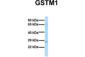 Host:  Rabbit  Target Name:  GSTM1  Sample Tissue:  Human Fetal Lung  Antibody Dilution:  1.