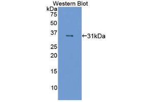Western Blotting (WB) image for anti-Coagulation Factor XIII, A1 Polypeptide (F13A1) (AA 140-377) antibody (ABIN1867819) (F13A1 antibody  (AA 140-377))