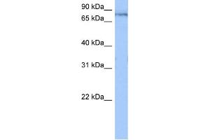 WB Suggested Anti-TTC14 Antibody Titration:  0. (TTC14 antibody  (N-Term))