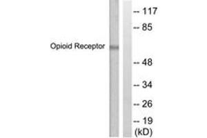 Western Blotting (WB) image for anti-Chemokine (C-C Motif) Receptor 5 (CCR5) (AA 303-352) antibody (ABIN2888592) (CCR5 antibody  (AA 303-352))