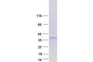 Methyltransferase Like 9 (METTL9) (Transcript Variant 1) protein (Myc-DYKDDDDK Tag)