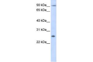 WB Suggested Anti-TSPAN31 Antibody Titration:  0. (TSPAN31 antibody  (Middle Region))