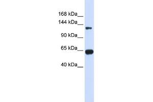 WB Suggested Anti-RGS22 Antibody Titration: 0. (RGS22 antibody  (N-Term))