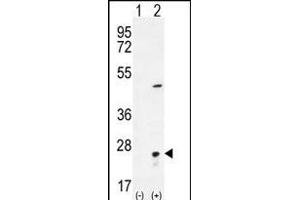 Western blot analysis of VSNL1 (arrow) using rabbit polyclonal VSNL1 Antibody (Center) (ABIN656135 and ABIN2845474).