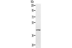 Gel: 8 % SDS-PAGE, Lysate: 40 μg, Lane: 231 cells, Primary antibody: ABIN7130778(PTPN7 Antibody) at dilution 1/300, Secondary antibody: Goat anti rabbit IgG at 1/8000 dilution, Exposure time: 1 minute (PTPN7 antibody)