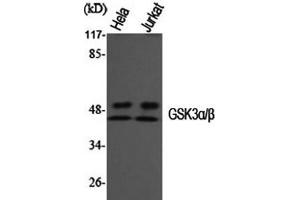 Western Blot analysis of Hela, Jurkat cells using GSK3 alpha/beta Polyclonal Antibody at dilution of 1:1000. (GSK3 alpha/beta antibody)