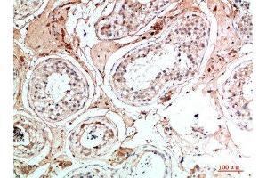 Immunohistochemical analysis of paraffin-embedded human-testis, antibody was diluted at 1:200 (Nanos Homolog 1 antibody  (AA 151-200))