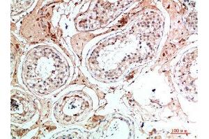 Immunohistochemical analysis of paraffin-embedded human-testis, antibody was diluted at 1:200 (Nanos Homolog 1 antibody  (AA 151-200))