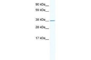 Human Thymus; WB Suggested Anti-RNF130 Antibody Titration: 2. (RNF130 antibody  (N-Term))