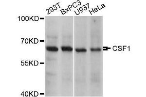 Western blot analysis of extracts of various cell lines, using CSF1 antibody. (M-CSF/CSF1 antibody)