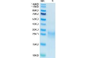 Biotinylated Human VEGF-C on Tris-Bis PAGE under reduced condition. (VEGFC Protein (AA 103-227) (His-Avi Tag,Biotin))