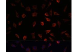 Immunofluorescence analysis of L929 cells using FABP1 Polyclonal Antibody at dilution of 1:100. (FABP1 antibody)