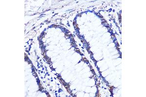Immunohistochemistry of paraffin-embedded Human colon using OTUD7B Rabbit pAb (ABIN7269125) at dilution of 1:100 (40x lens). (OTUD7B antibody  (AA 530-700))