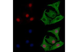 ABIN6264007 and ABIN6277984 staining Hela cells by IF/ICC. (Poly(A) Binding Protein, Cytoplasmic, Pseudogene 2 (PABPCP2) (C-Term) antibody)