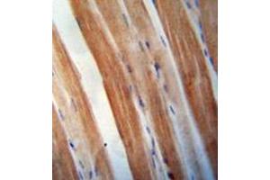 Immunohistochemistry analysis in formalin fixed and paraffin embedded human skeletal muscle reacted with KBTBD5 Antibody (Center) followed which was peroxidase conjugated to the secondary antibody and followed by DAB staining. (KBTBD5 antibody  (Middle Region))