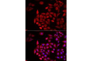 Immunofluorescence analysis of HeLa cells using COCH antibody (ABIN6132126, ABIN6138819, ABIN6138820 and ABIN6222234). (COCH antibody  (AA 20-260))