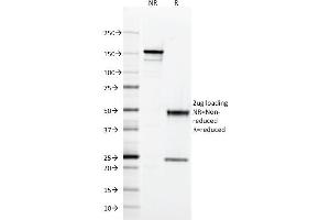 SDS-PAGE Analysis Purified HLA-DQ Mouse Monoclonal Antibody (SPV-L3). (HLA DQ antibody)