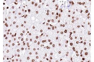 ABIN6272455 at 1/100 staining human liver tissue sections by IHC-P. (USP36 antibody)