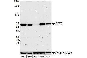 Western Blotting (WB) image for anti-Transcription Factor EB (TFEB) (AA 426-476) antibody (ABIN7453326)
